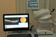 OCT-retinografo